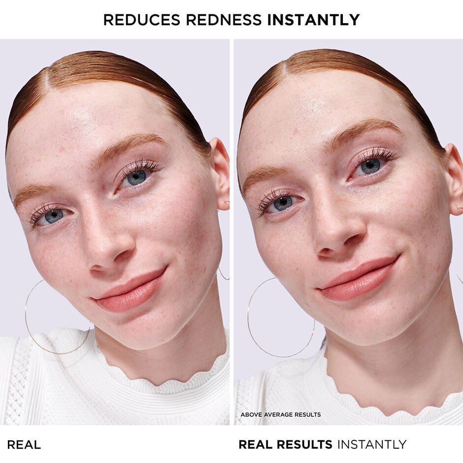 Bye Bye Redness Serum