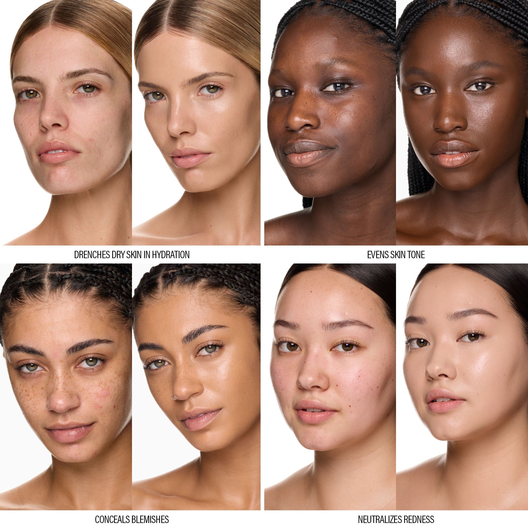 SURREALSKIN FOUNDATION – SurrealSkin Foundation – 9 W