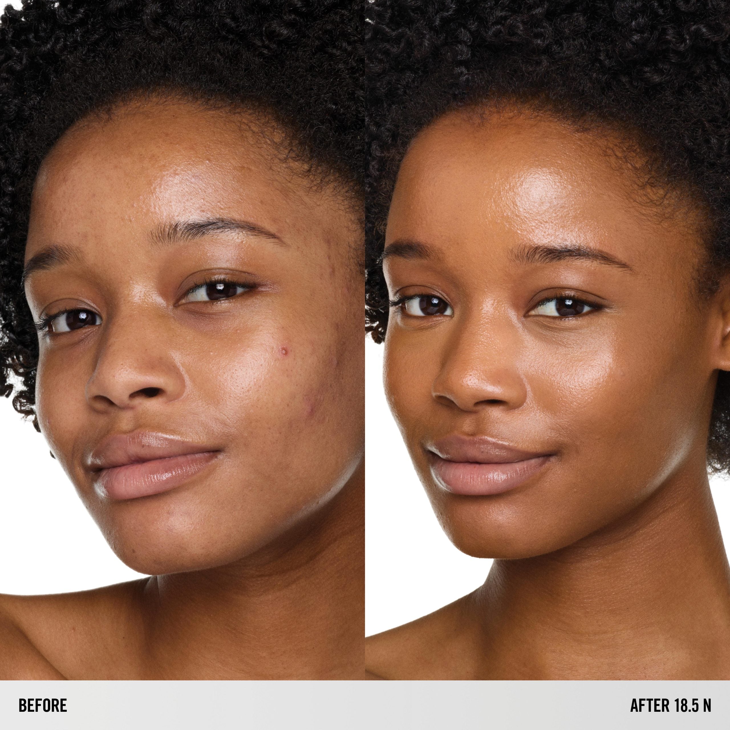 SURREALSKIN FOUNDATION – SurrealSkin Foundation – 18.5 N