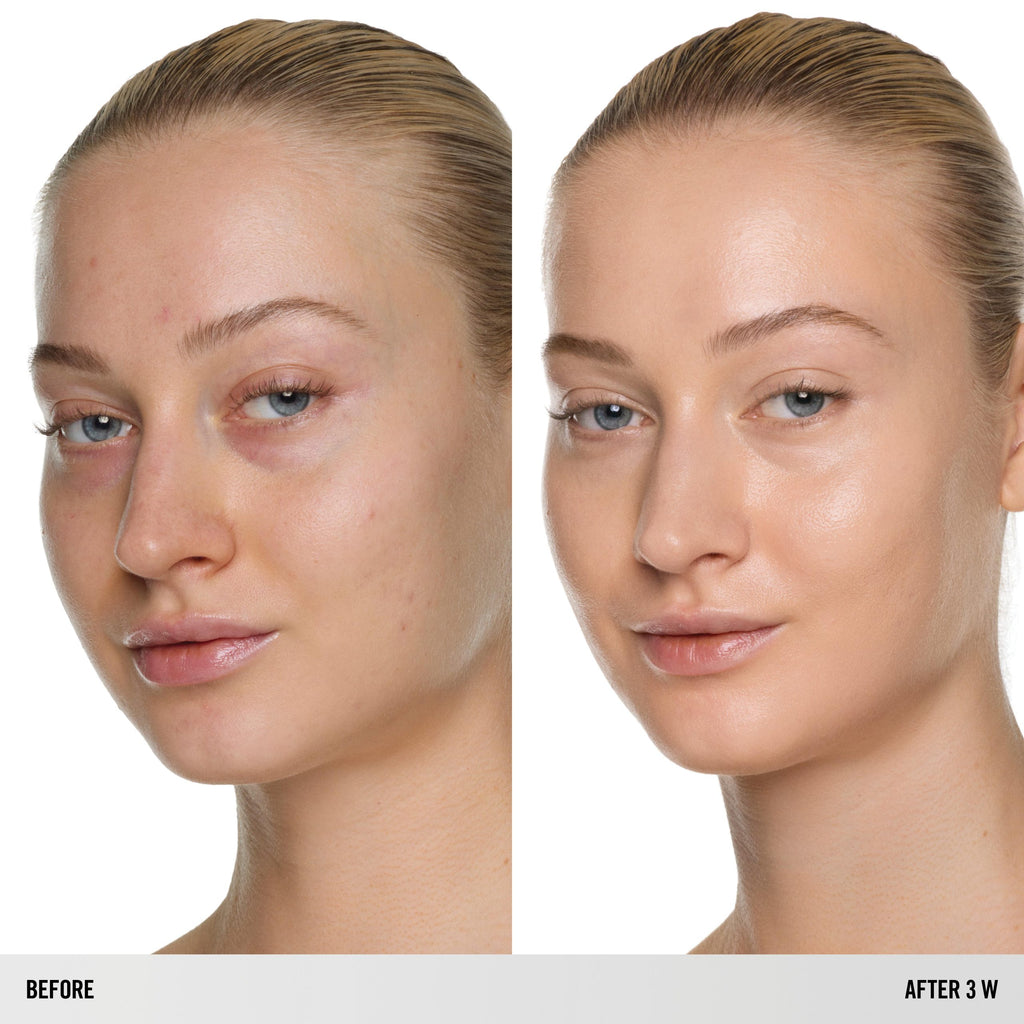 SURREALSKIN FOUNDATION – SurrealSkin Foundation – 3 W