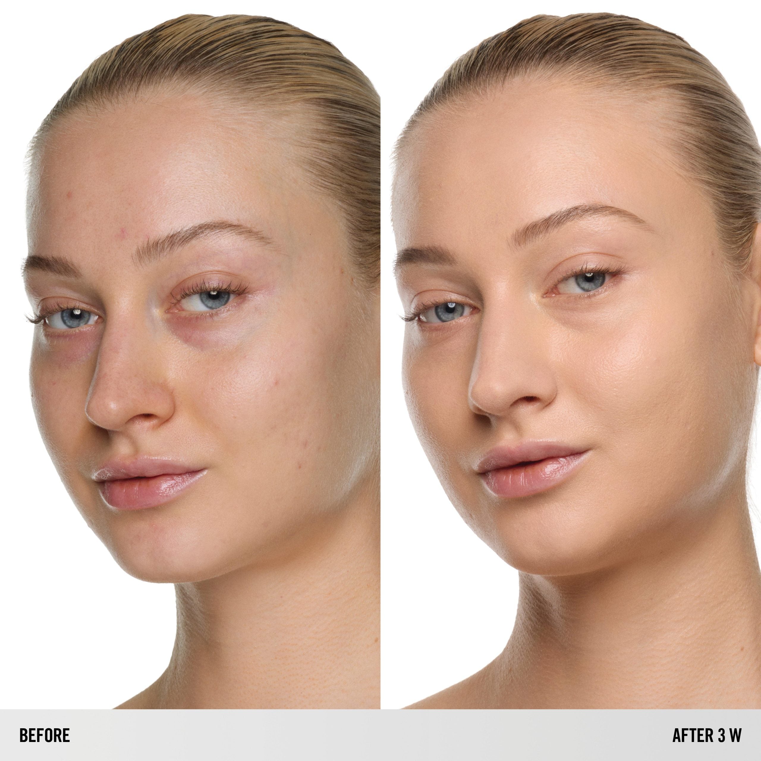 SURREALSKIN NATURAL FINISH FOUNDATION – SurrealSkin Natural Finish Foundation – 3 W
